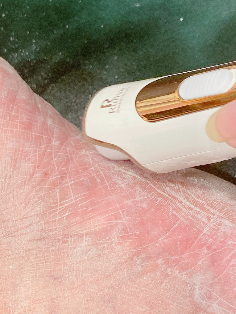 【好用小物】Runve美足賦活儀 快速去除足部的老化角質、硬皮！ @貝大小姐的多元心宇宙