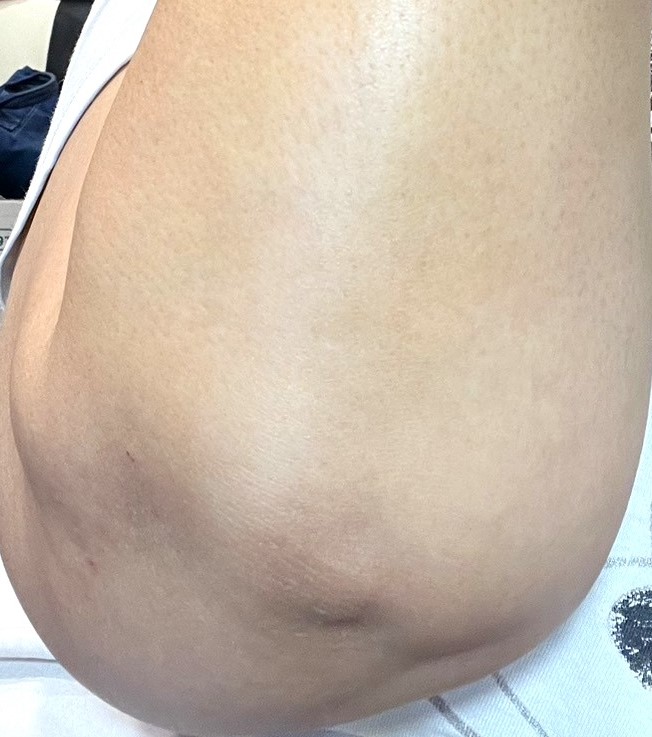 【網購 身體乳液推薦】超能橘身體乳液 清爽不黏膩的質地適合全身使用，讓肌膚留住水份維持濕潤！不論白天或晚上都可以使用&#8230; @貝大小姐的多元心宇宙