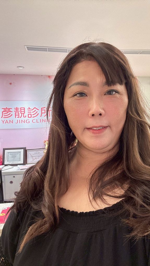【醫美 玻尿酸淚溝眼袋療程推薦】彥靚診所 黃政達醫師  眼下微調小心機，讓我拍照更有自信！ @貝大小姐的多元心宇宙