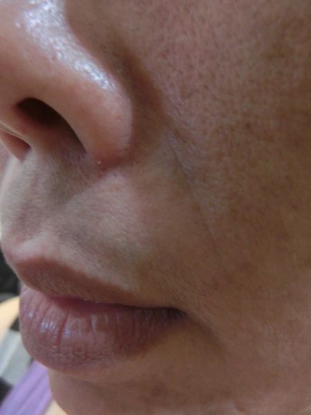 【保養好物推薦】MILDSKIN 巧克力粉刺速淨面膜 第二代 @貝大小姐的多元心宇宙