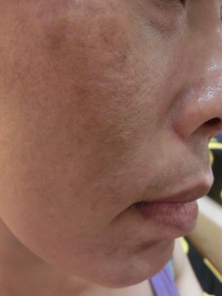 【保養好物推薦】MILDSKIN 巧克力粉刺速淨面膜 第二代 @貝大小姐的多元心宇宙